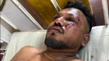 Число погибших при крушении самолета в Индии превысило 290 человек